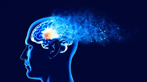 Vinculan la demencia con problemas en el sistema de eliminación de residuos del cerebro Vinculan la demencia con problemas en el sistema de eliminación de residuos del cerebro