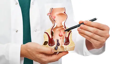 Proctólogo señalando patologías del recto Proctólogo señalando patologías del recto