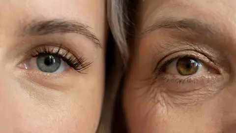 Envejecimiento Envejecimiento