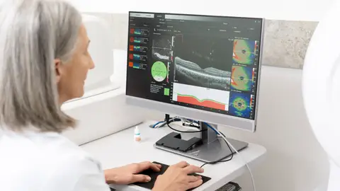 Médico senior analizando la tomografía de coherencia óptica Médico senior analizando la tomografía de coherencia óptica