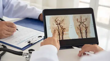 Equipo médico de radiología que busca una radiografía del cerebro para diagnosticar un accidente cerebrovascular isquémico Equipo médico de radiología que busca una radiografía del cerebro para diagnosticar un accidente cerebrovascular isquémico