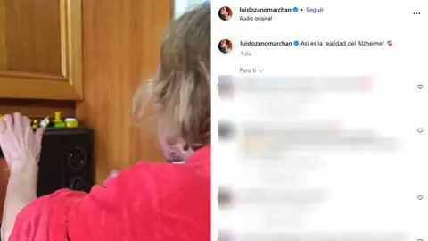 Vivir con Alzheimer: Un joven comparte en redes sociales como es vivir día a día con su madre quien sufre esta enfermedad Vivir con Alzheimer: Un joven comparte en redes sociales como es vivir día a día con su madre quien sufre esta enfermedad