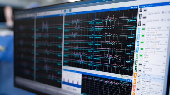 Electrocardiograma