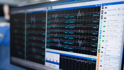 Electrocardiograma Electrocardiograma