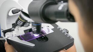 Una mol&eacute;cula logra "reprogramar" las defensas del cerebro frente al alzh&eacute;imer